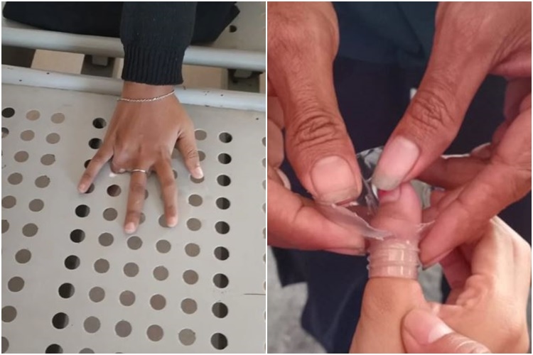 5 Aksi Damkar Yogyakarta yang di Luar Nurul, Bebaskan Jempol Pelajar Nyangkut di Botol Minum sampai Kejepit Lubang Kursi Kampus